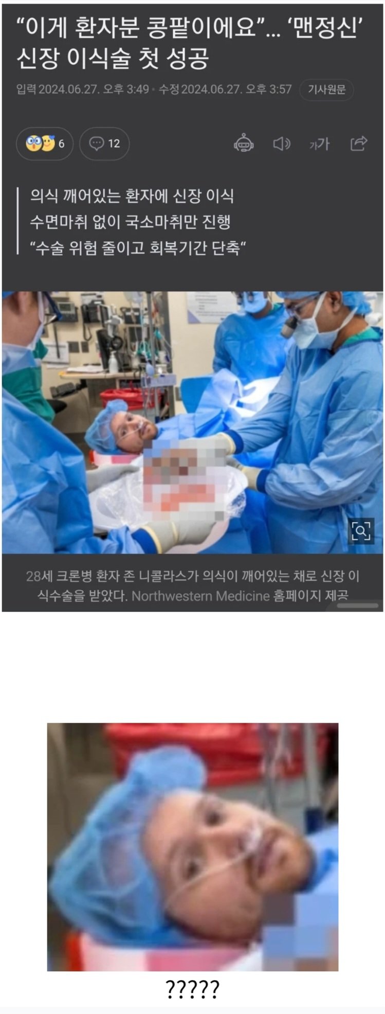 이게 환자분 콩팥입니다