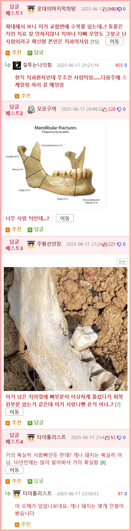 밭에서 이상한 뼈를 본 블라인.jpg