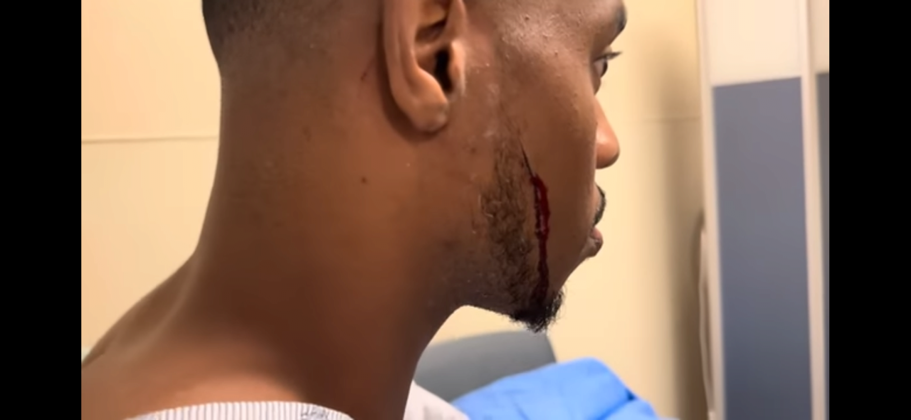 (약혐 깜놀주의) 둘이 먹다 하나 죽을뻔한 햄버거 먹방