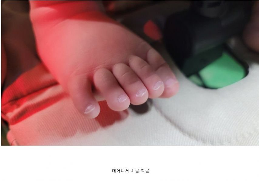 살면서 처음 발톱 깎았다는 여자 발상태